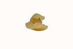 OsteoSelect® DBM Putty (74% Bone/Filler)