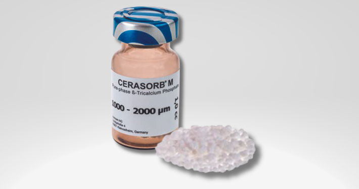 Cerasorb M - 5pk 2.0cc vials, 1000-2000µm